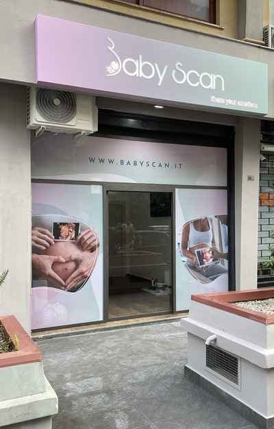 Baby Scan